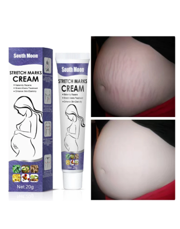 CREMA PARA ELIMINAR ESTRÍAS...